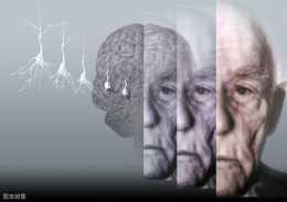醫生提醒：可能導致記憶力減退或痴呆的藥物，服用需謹慎