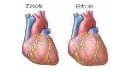 這個心臟瓣膜“開關”壞了，心臟會變大！