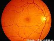 冷空氣可能導致的眼部血管問題